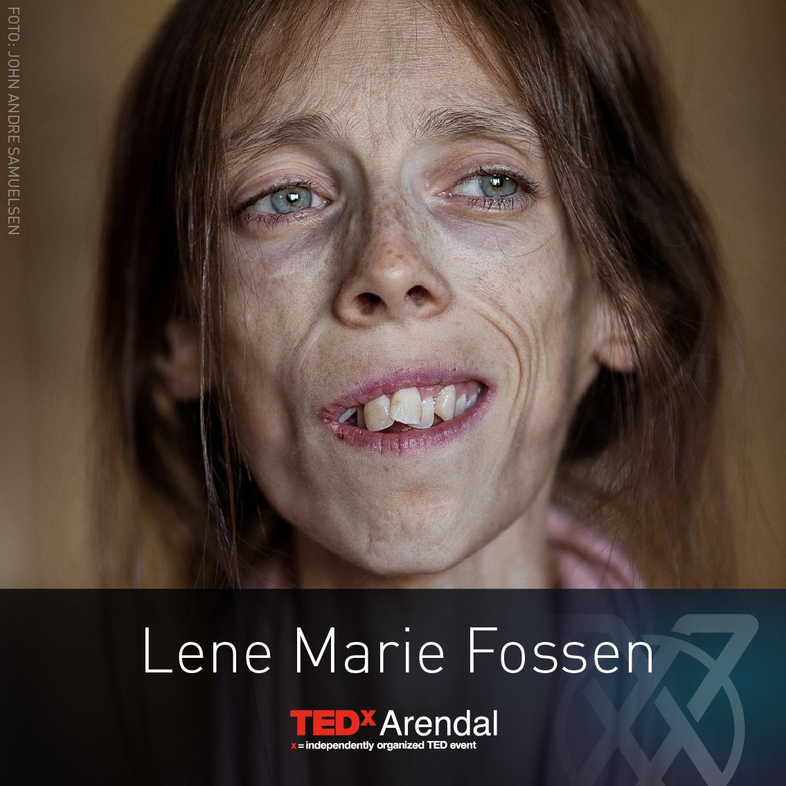 Lene Marie Fossen